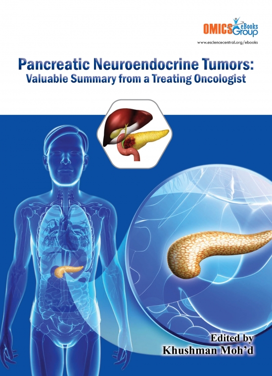 Pancreatic Neuroendocrine Tumors Valuable Summary from a